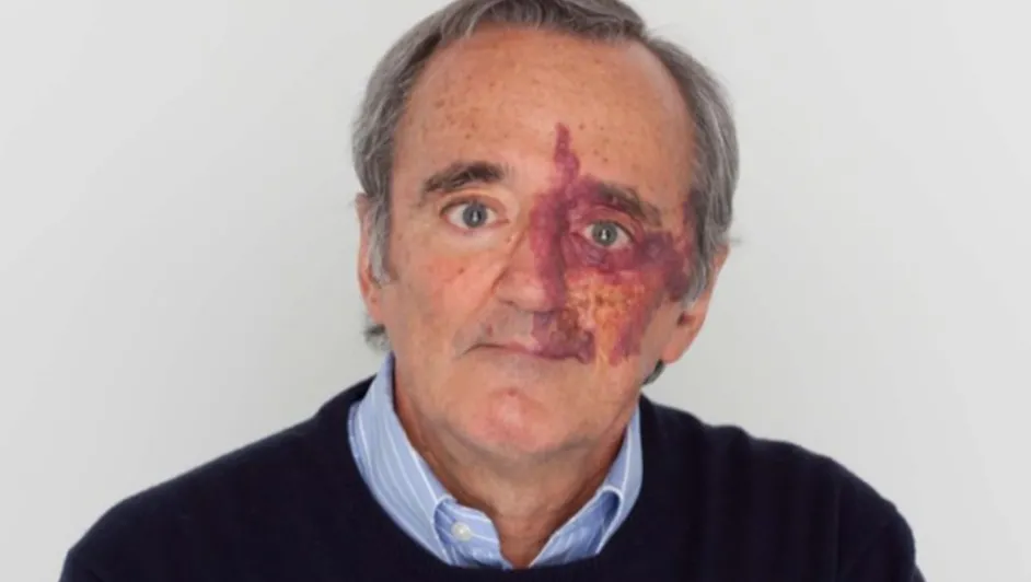 Academia de Ciencias de EU retira estudio sobre cáncer de páncreas