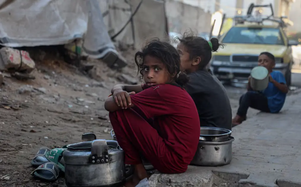 Al menos 21 niños mueren por desnutrición en Gaza en solo tres días