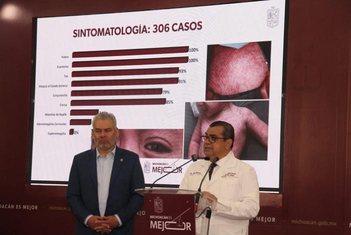 Al momento hay 18 casos activos de sarampión en Michoacán; estos son los municipios con más casos