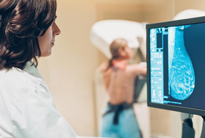 Cáncer de mama no espera a los 40: miles de jóvenes mexicanas enfrentan la enfermedad