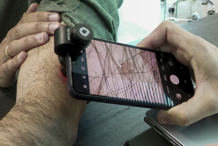 Científicos mexicanos investigan el desarrollo del cáncer de piel más común en el país