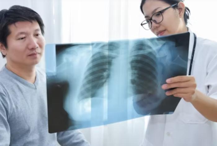 Día Mundial de la Fibrosis Quística