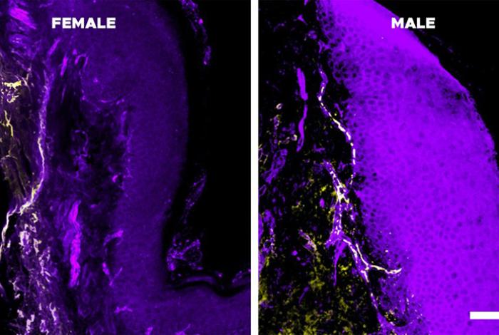 El sistema inmunitario, la causa de que el dolor crónico dure más en las mujeres