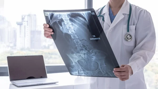 Especialistas llaman a vigilar síntomas de cáncer óseo en menores