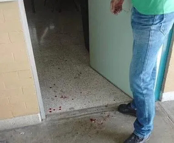  Estudiante de la UNAM ataca a profesor en CCH Naucalpan con arma blanca