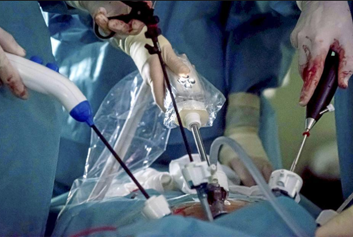 Estudio internacional concluye que el cribado del cáncer de próstata reduce la mortalidad