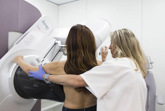 Expuestas al cáncer de mama, 35 millones de mujeres en México; solo 32 % están bien informadas