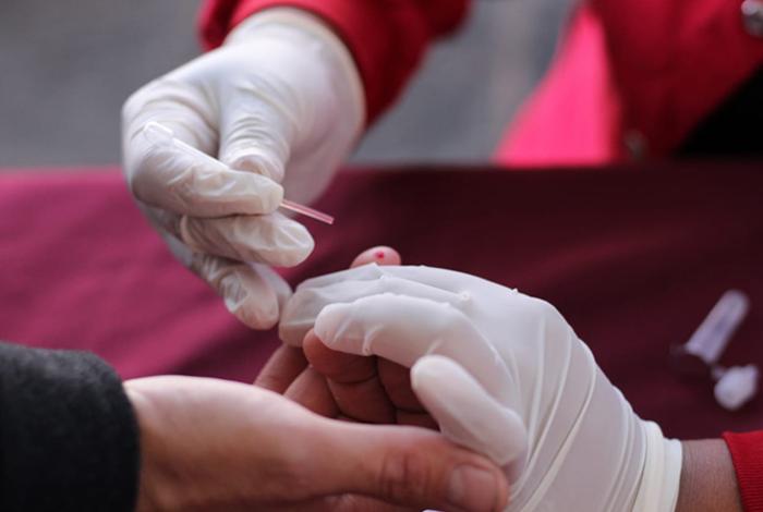 Identifican cerca de 15,500 nuevos casos de VIH en 2025 en México