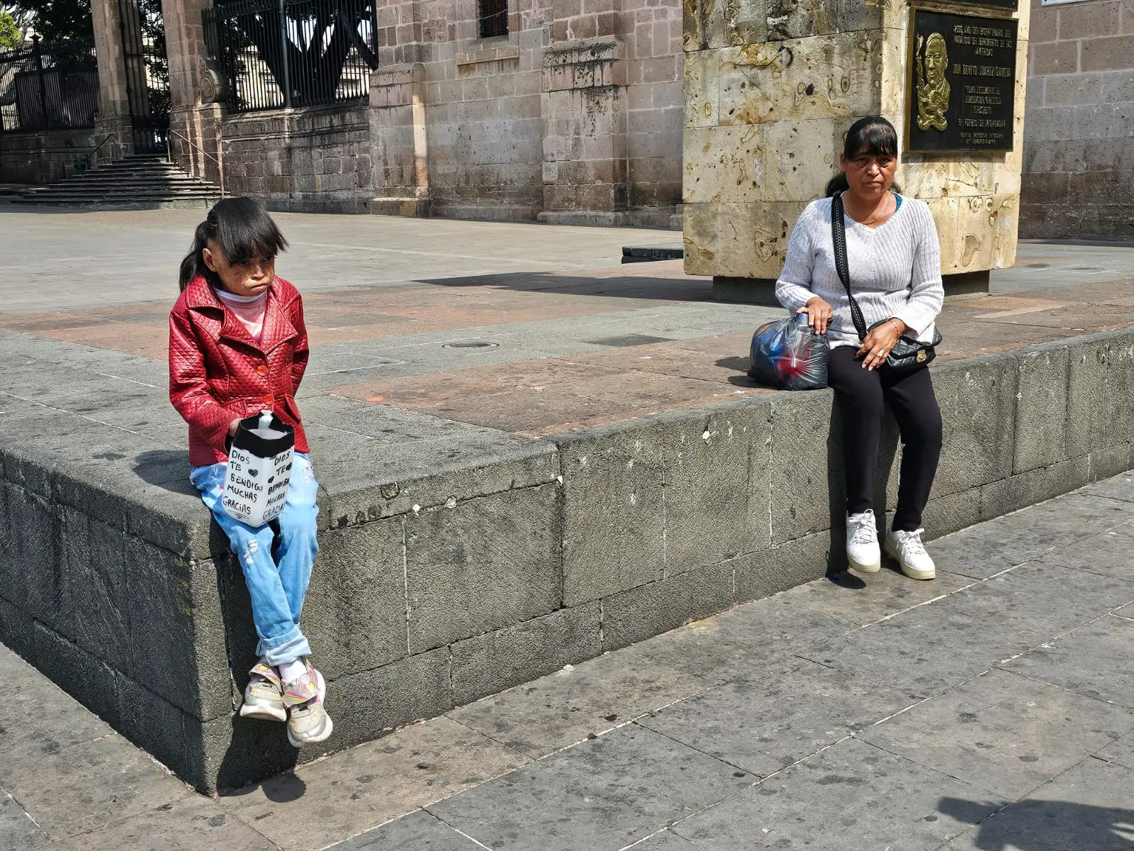 La lucha silenciosa de Verónica y su hija: vivir con epidermólisis bullosa