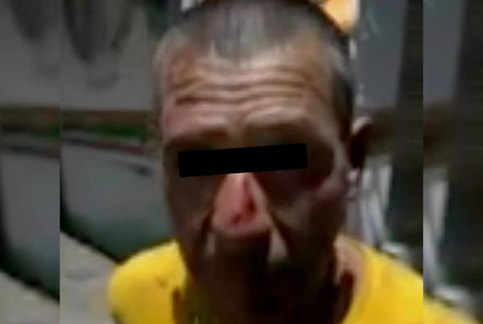 Presunto ladrón es golpeado por vecinos, quienes le amputaron un dedo, en Uruapan