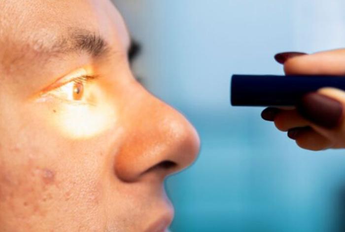 Radiación UV aumenta el riesgo de enfermedades oculares, advierten oftalmólogos