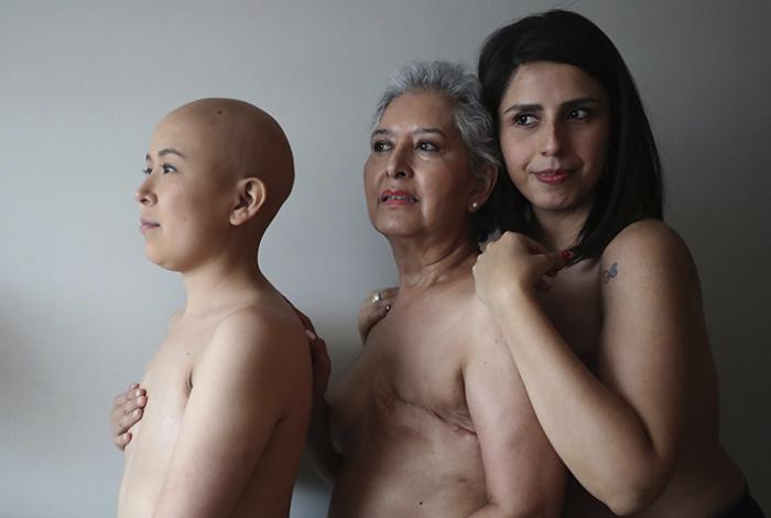 Revelan por qué el riesgo de cáncer de mama aumenta tras la menopausia