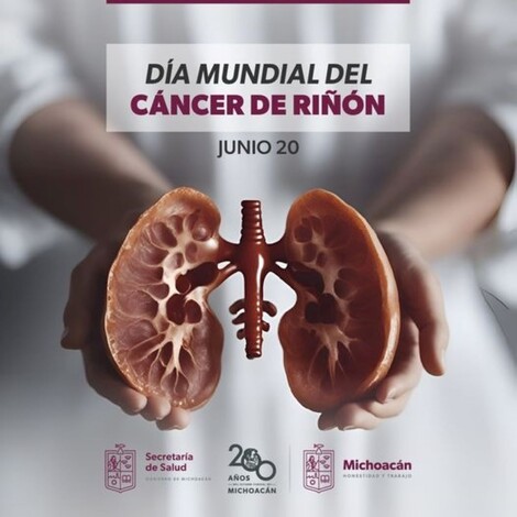 #Salud | Conoce los síntomas del cáncer de riñón para detectarlo a tiempo: SSM