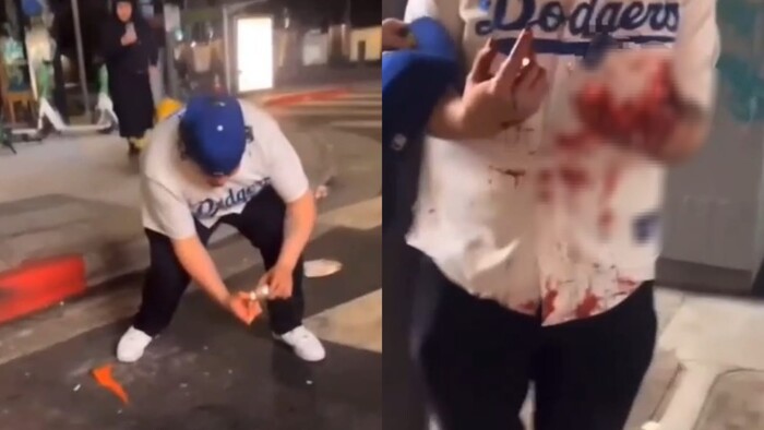 #Video | Fan se explota la mano con petardo en celebración por el triunfo de los Dodgers